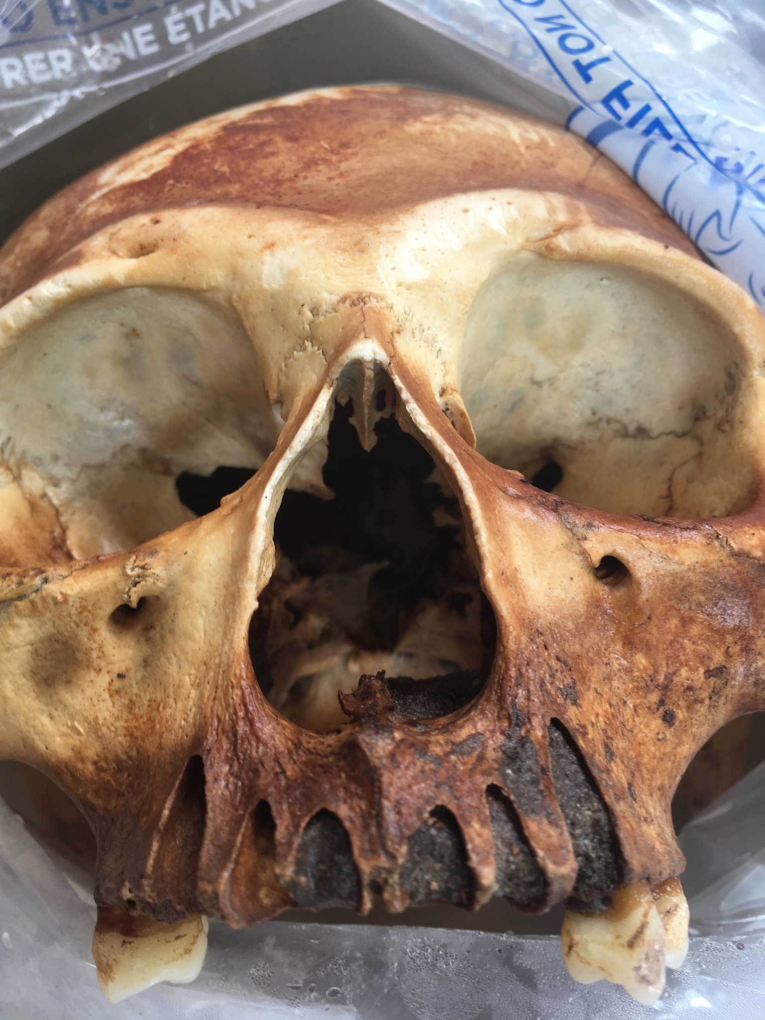 skull.jpg